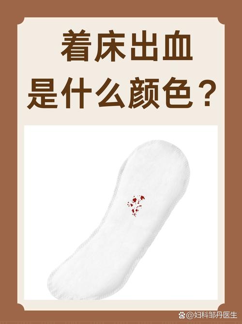 着床成功后出血图片解析:正常症状与异常情况对比指南(附高清图) 着床成功后出血图片解析:正常症状与异常情况对比指南(附高清图)